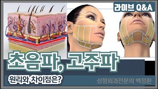 초음파, 고주파 리프팅 원리와 차이는?