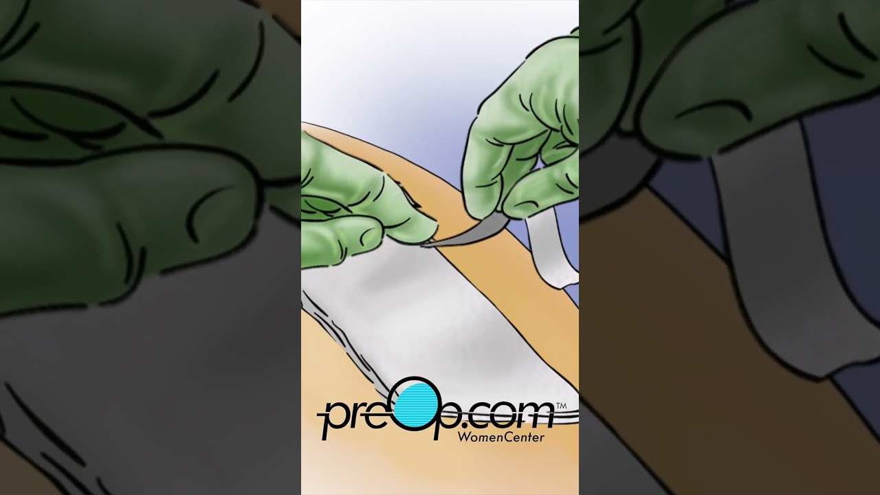 PreOp® 💊 Advanced Wound Care Techniques 