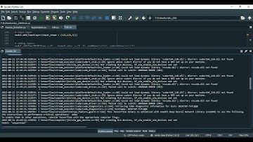 Deep Learning Based Glaucoma Detection With Cropped Optic Cup and Disc and Blood Vessel Segmentation
