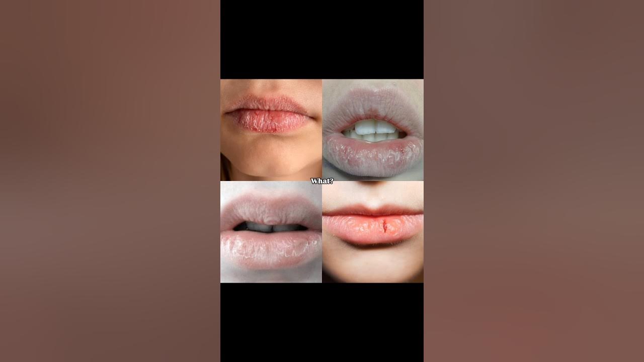 Chapped Lips Solution That Works | Best Lip Care Products You Need #shorts #lipcare #nivea #selfcare Chapped Lips Solution That Works | Best Lip Care Products You Need #shorts #lipcare #nivea #selfcare