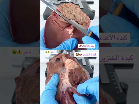 مقارنه كبدة الخنزير وكبدة الأغنام  اكسبلور  معلومات شورت ترند