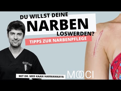 Video: Tummy Tuck Narben: Vorbeugung, Behandlung Und Entfernung