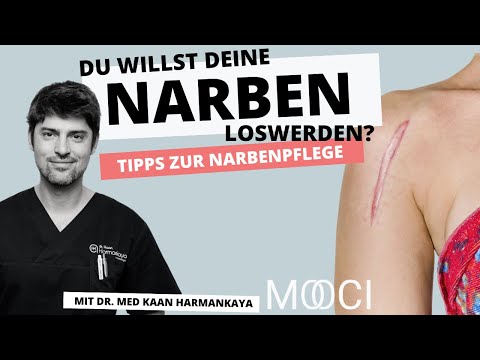 Video: Wie Reinigt Man Eine Narbe