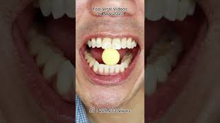 Satisfying Chewing ASMR #Compilation #ASMR #DoctorTristanPeh