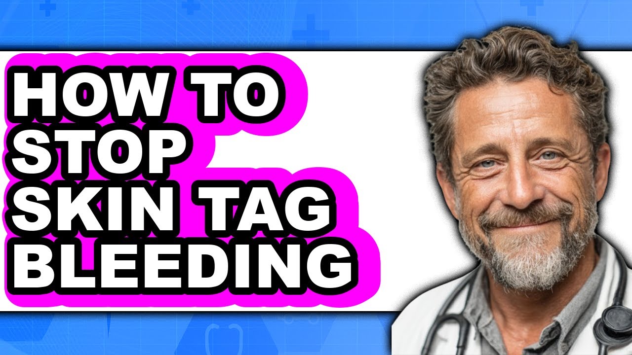 How to Stop Skin Tag Bleeding (full Guide) - YouTube