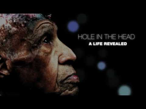 Hole In the Head: A Life Revealed Vertus Hardiman hid a shocking secret under a wig & beanie for over 80 years. He was experimented on at age of 5 by a county hospital in Indiana during 1927. Vertus was one of ten children, all experimented on with radiation that day. FOR MORE INFORMATTION ON MOVIE AND PRINT RELEASES, PLEASE VISIT THE WEBSITE AND SIGN UP. www.smithleonardproductions.com Narrated By Dennis Haysbert Directed By: Brett Leonard Written By: Wilbert Smith Ph.D. & Brett Leonard Produced By: Wilbert Smith Ph.D. Awards: International Film Festival Of Nashville, Director's Choice Award-For Socially Relevant Subject. Pan African Film Festival of Los Angeles, Nominated for Best Documentary Award.