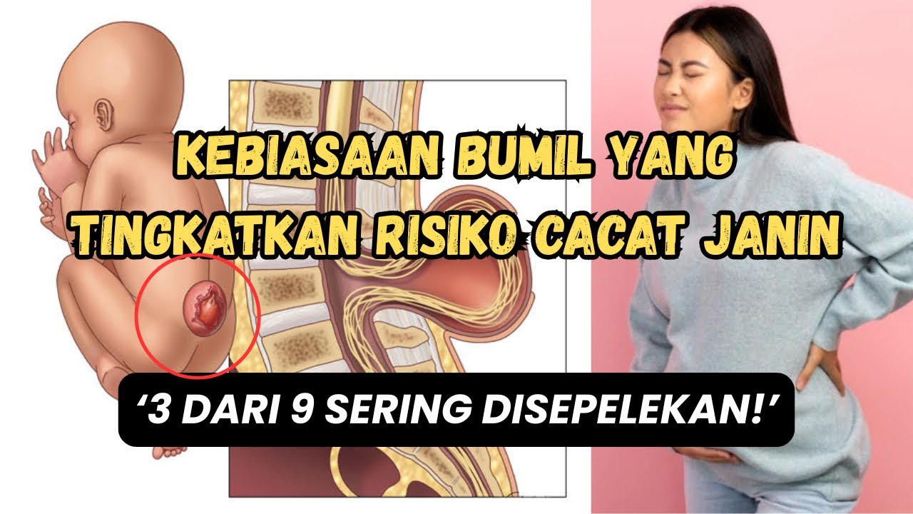 Kebiasaan Ibu Hamil Ini bisa Meningkatkan Risiko Cacat Lahir pada Janin
