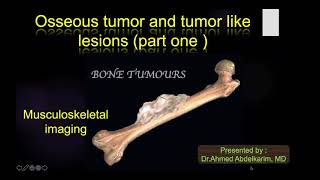 19-bone tumour and tumour like lesion part 1