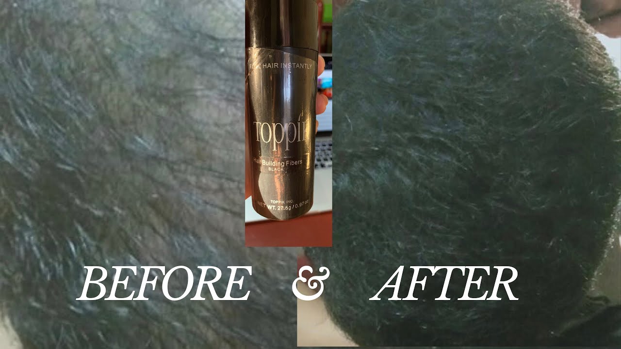 TOPPIK HAIR BUILDING FIBER BEFORE&AFTER YouTube
