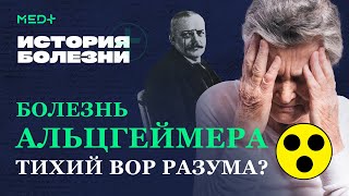 Потеря памяти, рассеянность, нарушение речи: болезнь Альцгеймера | История болезни