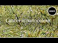 Cancer in nanocolour: a new type of microscope slide