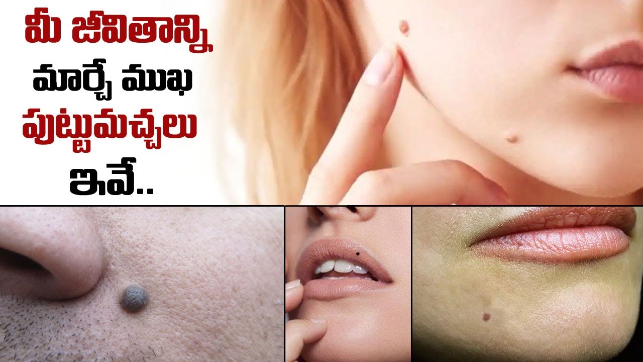 మీ జీవితాన్ని మార్చే ముఖ పుట్టుమచ్చలు ఇవే \| Moles On Face Indicates Your Future Prediction | M QUBE