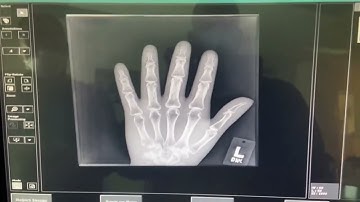 Transferring images from the Agfa 30x *Not for Medical Usage **