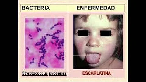 ¿Cuáles son las 3 enfermedades más comunes causadas por bacterias?