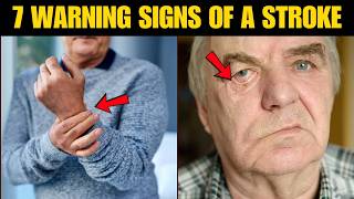 7 Warning Signs of a Stroke You’re Probably Ignoring (Symptom #5 is Shocking)
