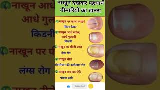 नाखून देखकर पहचाने बीमारियों का खतरा #healthguide