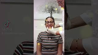 La magia hecha realidad. #viral #energia #fonoaudiología #sordo
