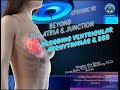 Master the Beat Series–Episode10: Beyond Atrial Junction – Decoding Ventricular Arrhythmias - ACLS