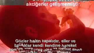 Allah Ol Der Ve Olur.