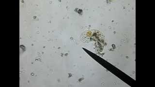 Amoeba (4x Speed)
