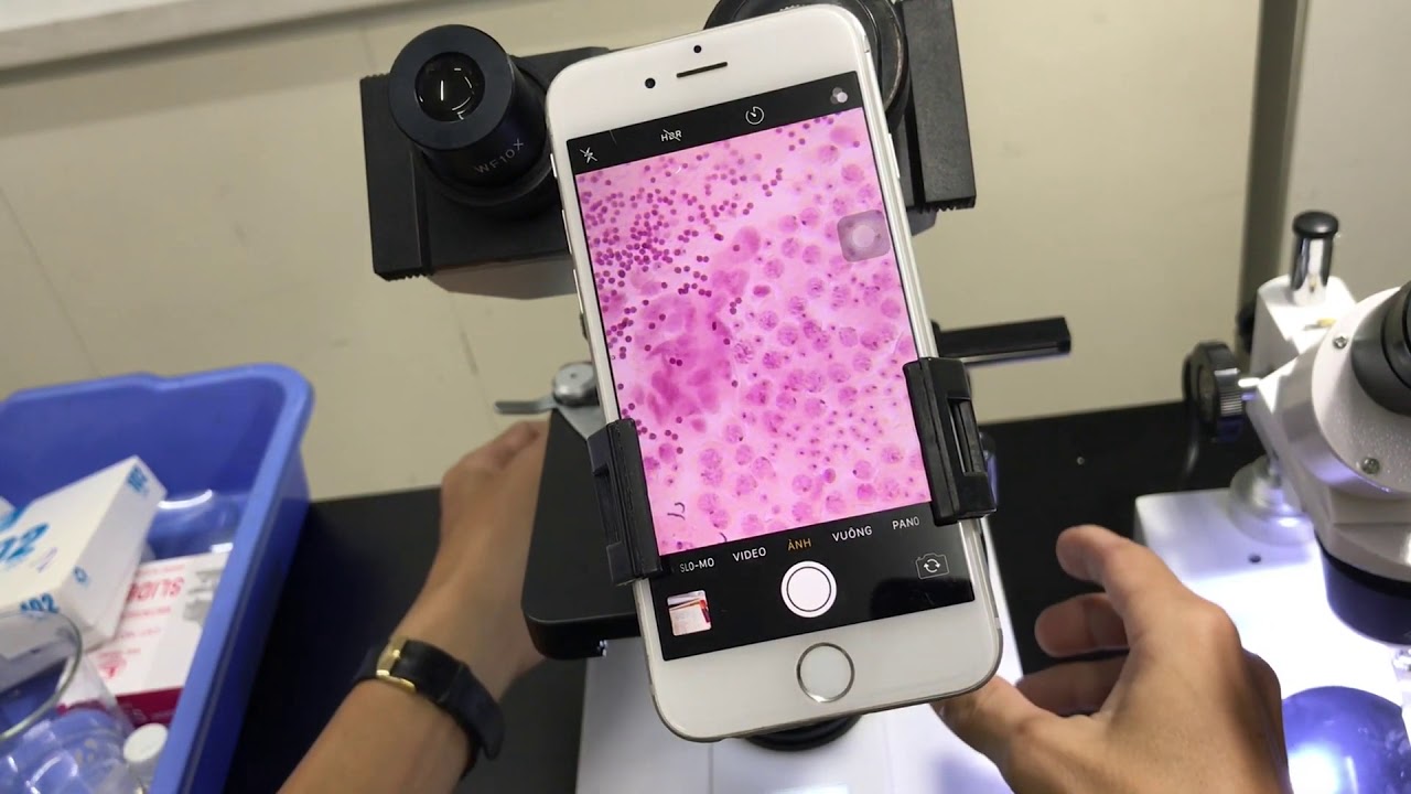 thực hành phân bào ở châu chấu (sưu tầm thầy Đức)