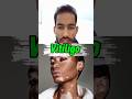 Why Does Vitiligo Happen? (Autoimmune Disease Explained Fast!)#shorts #vitíligo