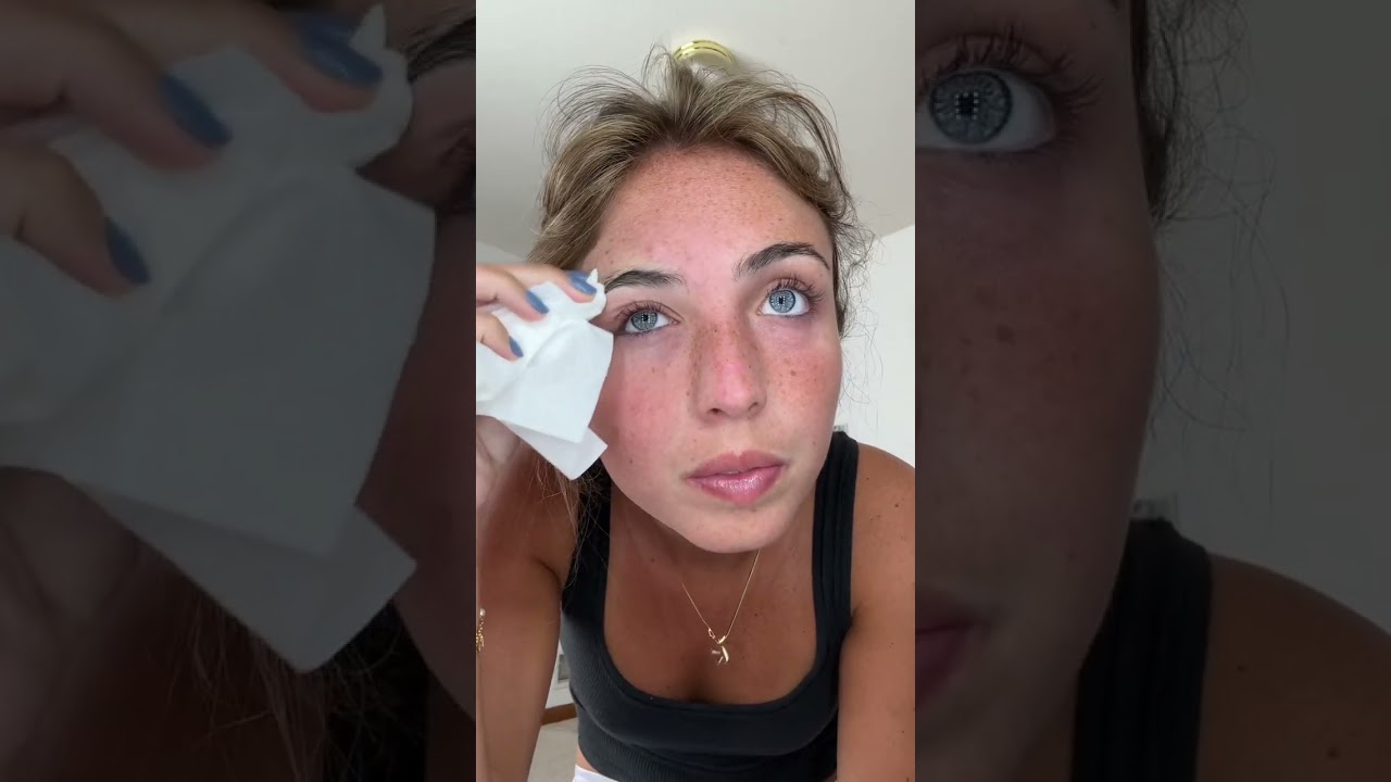 kate💋 i would still recommend using calamine lotion but heyyy it lowkey worked!