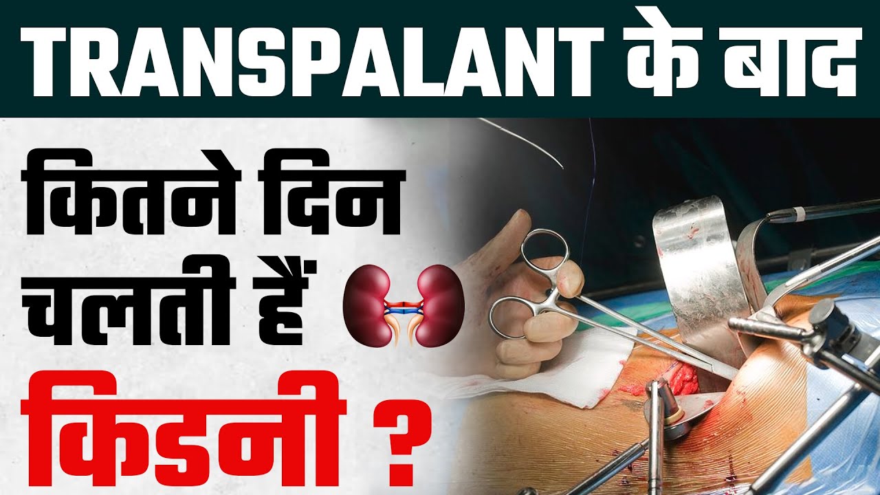 ट्रांसप्लांट के बाद कितने दिन चलती हैं किडनी | Kidney Transplant in Hindi | Transplant kaise karaye