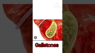 Udiliv 150mg in hindi, Use #pharmcist #biology #pharmcology #nursing