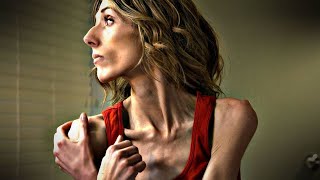 Woman Who Weighs 75 Pounds: ‘I Love Seeing The Bones Sticking Out’