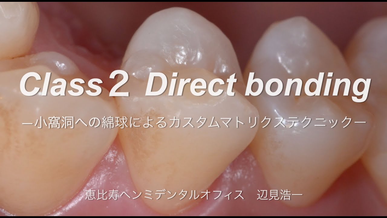 審美修復 症例 恵比寿ヘンミデンタルオフィス