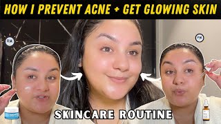 How I Prevent Comedonal Acne Get Glowing Skin At The Same Time