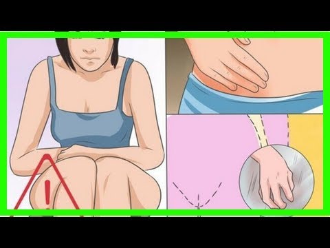 Video: Vaginale Candidiasis - Symptome, Behandlung, Ursachen