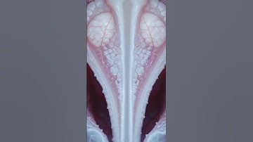 CinematicBladderMacro Anatomy |TrigoneDescent MedicalVisualization#MedicalMacro#AnatomyVisualization