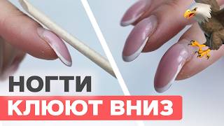 Клюющие Ногти Это Опасно Исправление Гелем Грифозных Ногтей