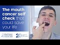 How to do a mouth cancer check at home