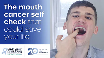 How to do a mouth cancer check at home