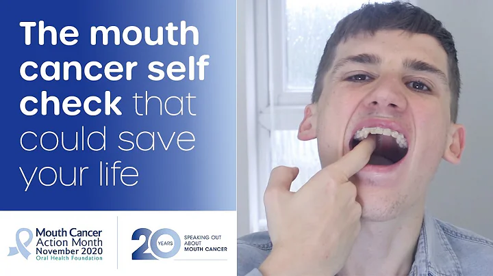 How to do a mouth cancer check at home - DayDayNews