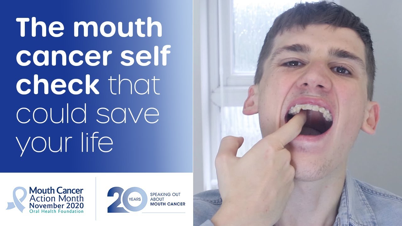 How You Can Do A 45 Second Mouth Cancer Check As Part Of Blue Wednesday Oral Health Foundation