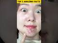 What Pimples on Your Face Reveal About Health!🤯⚠️#facts #skincare #pimplecare #youtubeshorts