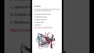 Medicine & Surgery MCQs (For MBBS, USMLE, MCCQE & PLAB)