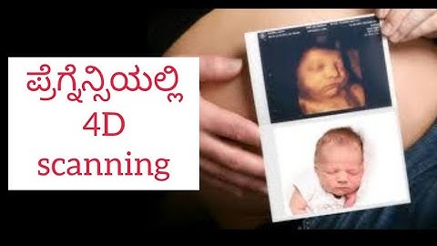 4D scanning during pregnancy in kannada | Pregnancy scanning details in kannada | real image