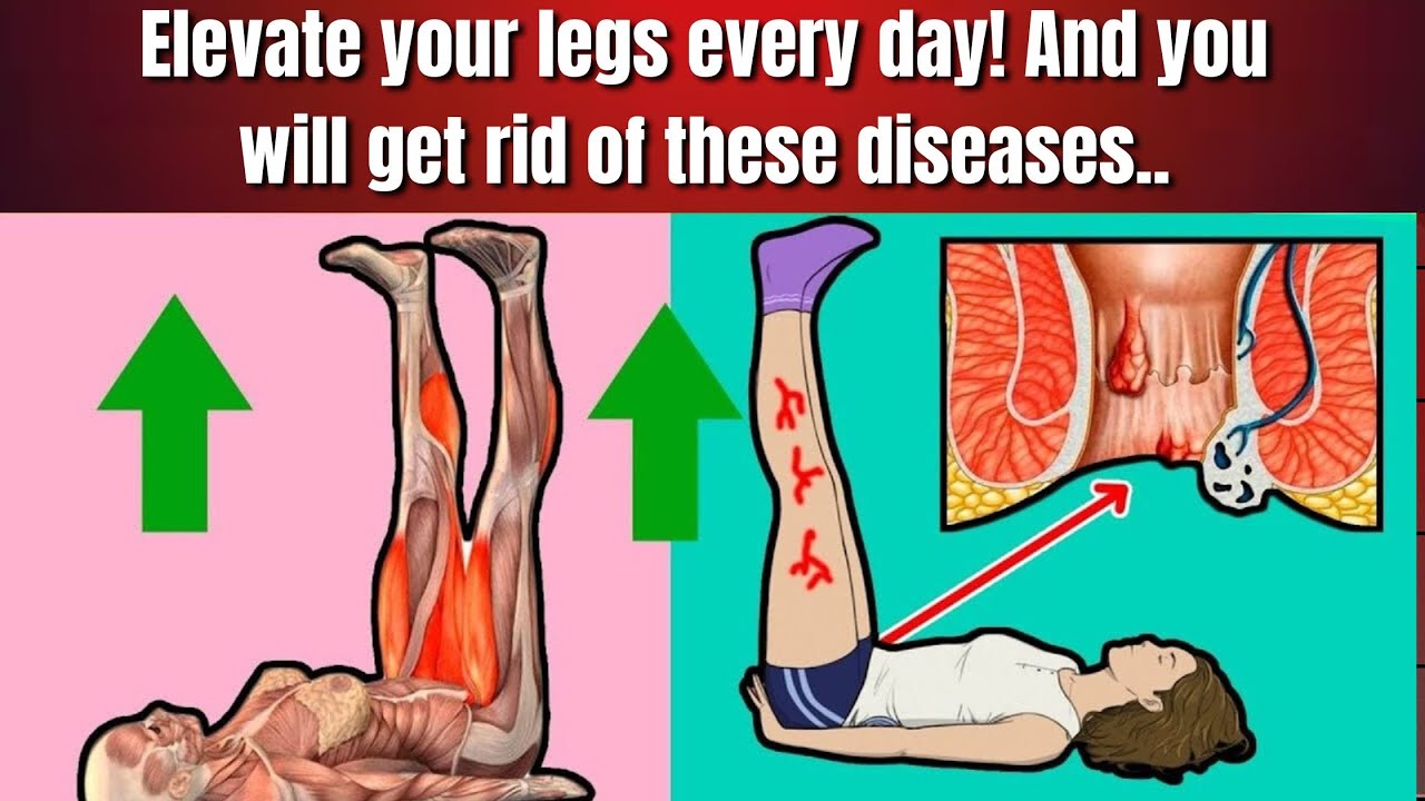 Elevate Your Legs Daily: Say Goodbye to These Common Health Issues ...