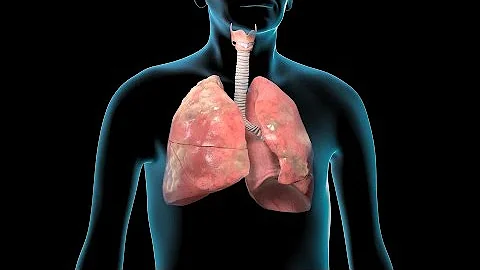 ¿Cómo están los pulmones con EPOC?