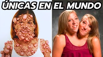 15 Personas Únicas En El Mundo - INCREÍBLE