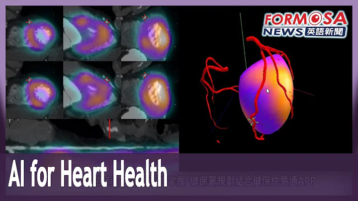 New AI system from NTUH could help doctors diagnose heart disease earlier