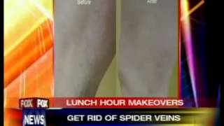 Dr. Greg Wiener of The Art of Plastic Surgery on FOX Chicago - Lunch Hour Makeovers