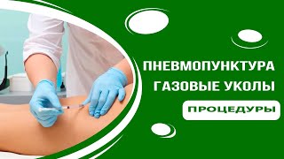 Пневмопунктура - газовые уколы СО2 и О3 Пневмопунктура - газовые уколы СО2 и О3