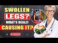 3-Day Strategy to Reduce Leg Swelling and Boost Mobility if You’re 70 and Beyond | Elderly Caretaker
