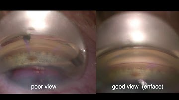 istent teaching nov 2019